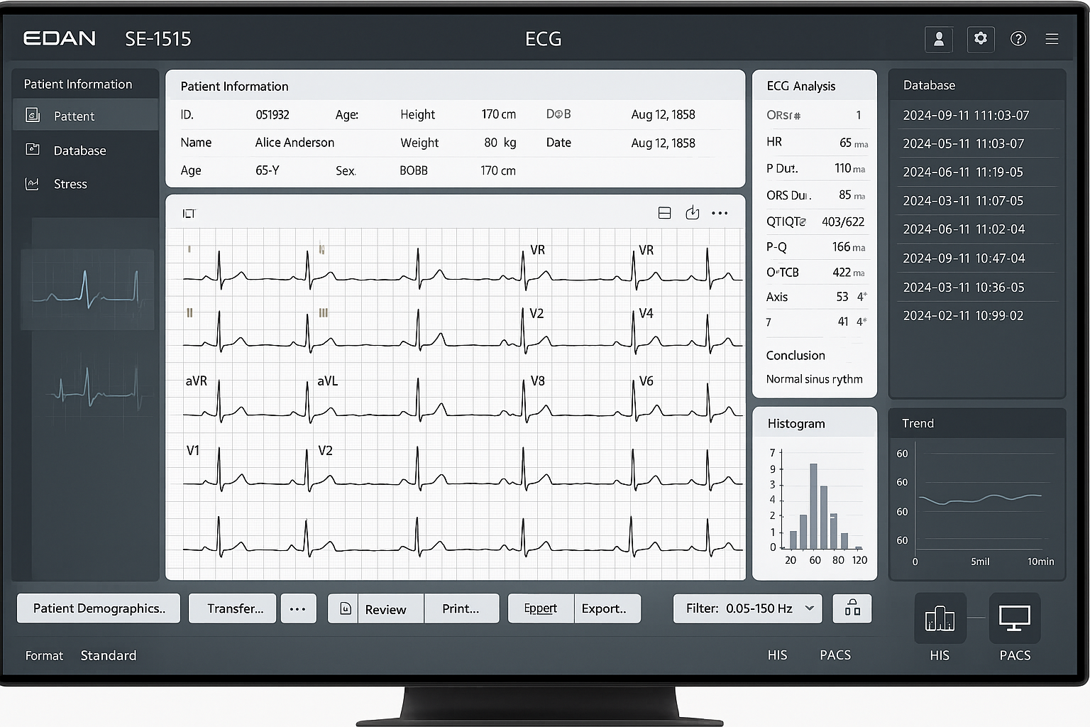 SE-1515 Software Interface