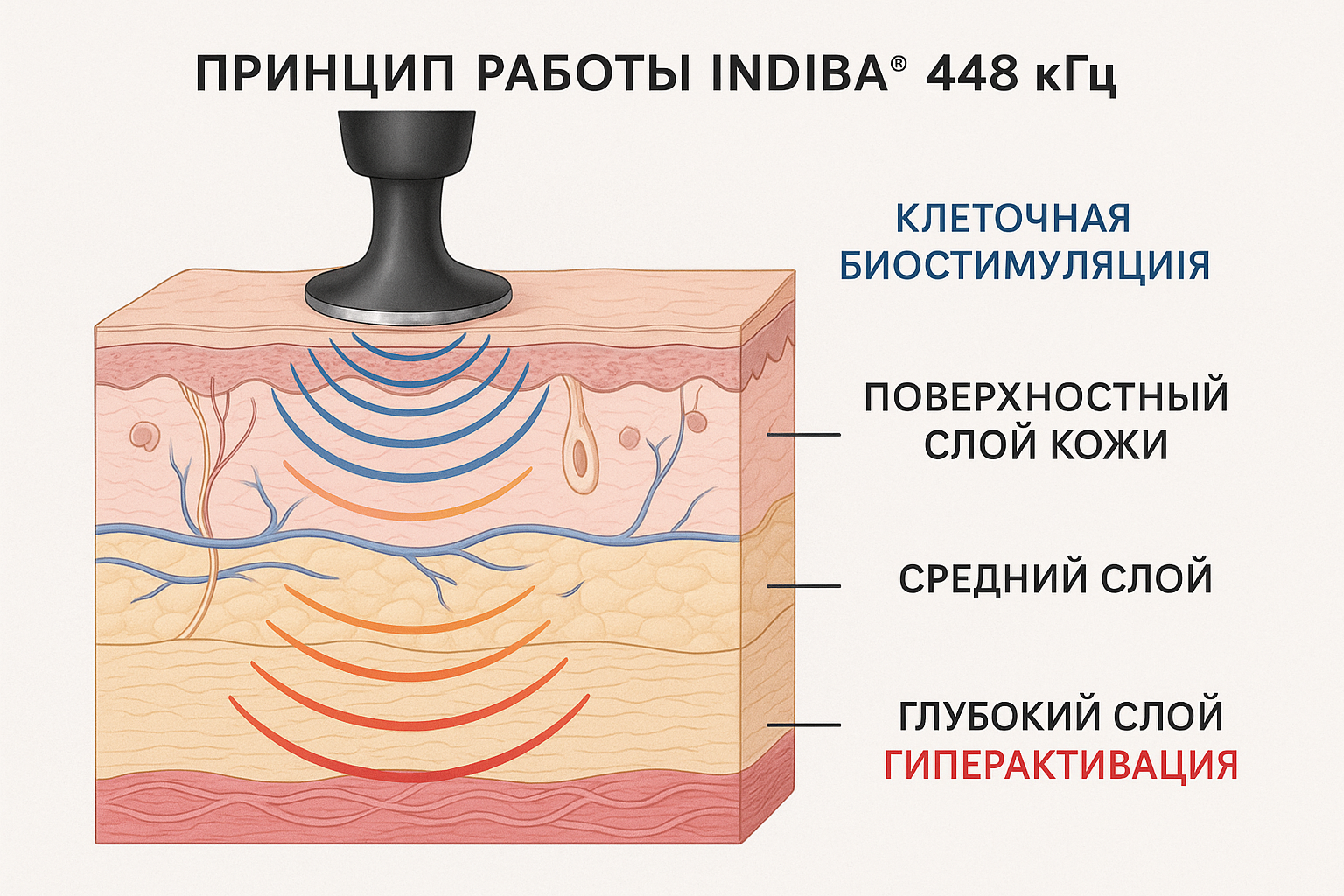 Принцип работы INDIBA 448 кГц