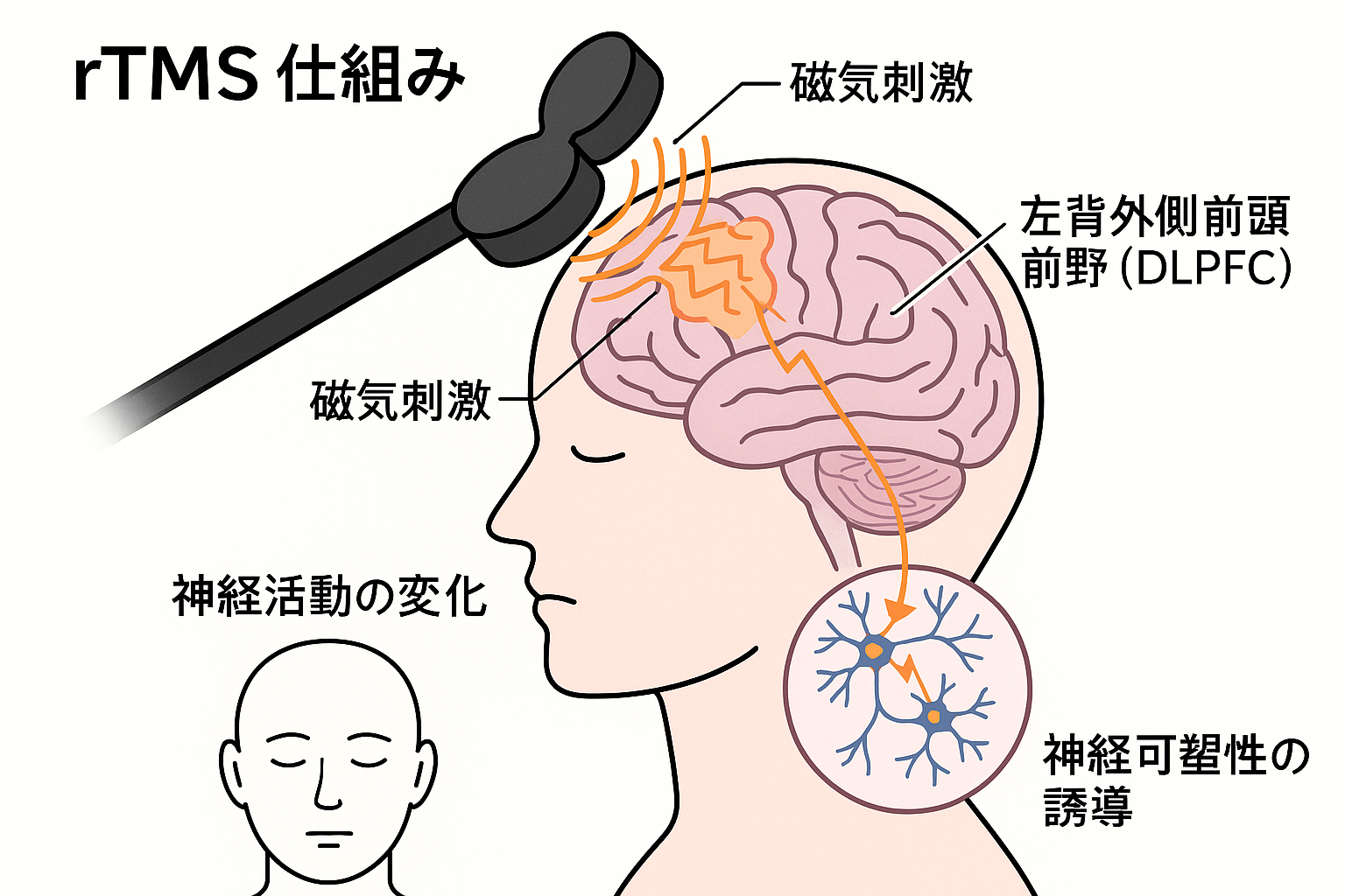 rTMSの仕組み